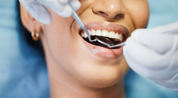 Best Emergency Broken Tooth Repair in Darien Downtown, CT